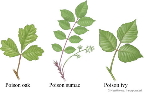 poison-leaves